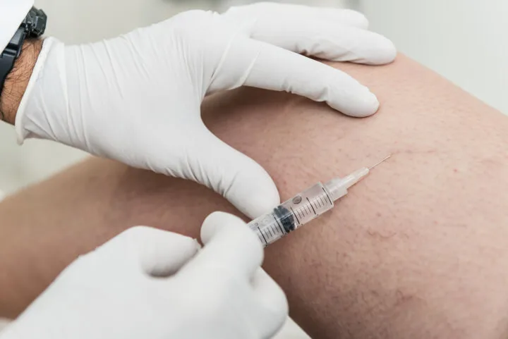 doctor performing sclerotherapy for varicose veins