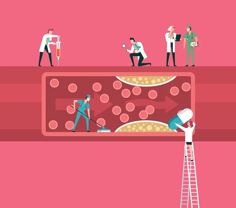 Doctors examining a blood vessel
