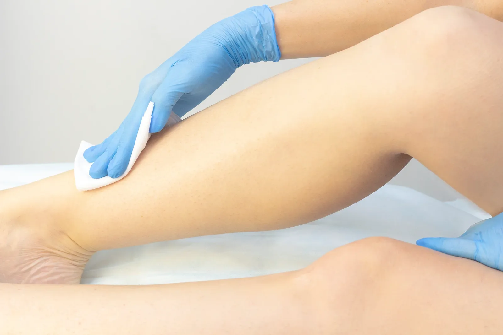 How Do You Treat Edema When You Have Chronic Venous