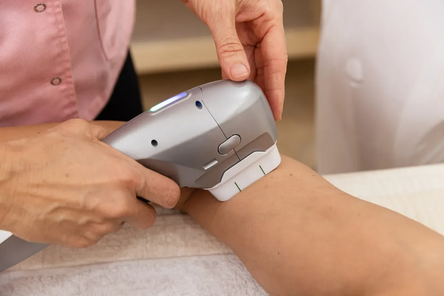 IPL for Spider Veins: Effective Treatment for Face & Legs?