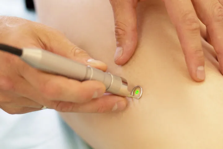 professional vein doctor performing laser vein removal on a patient's leg