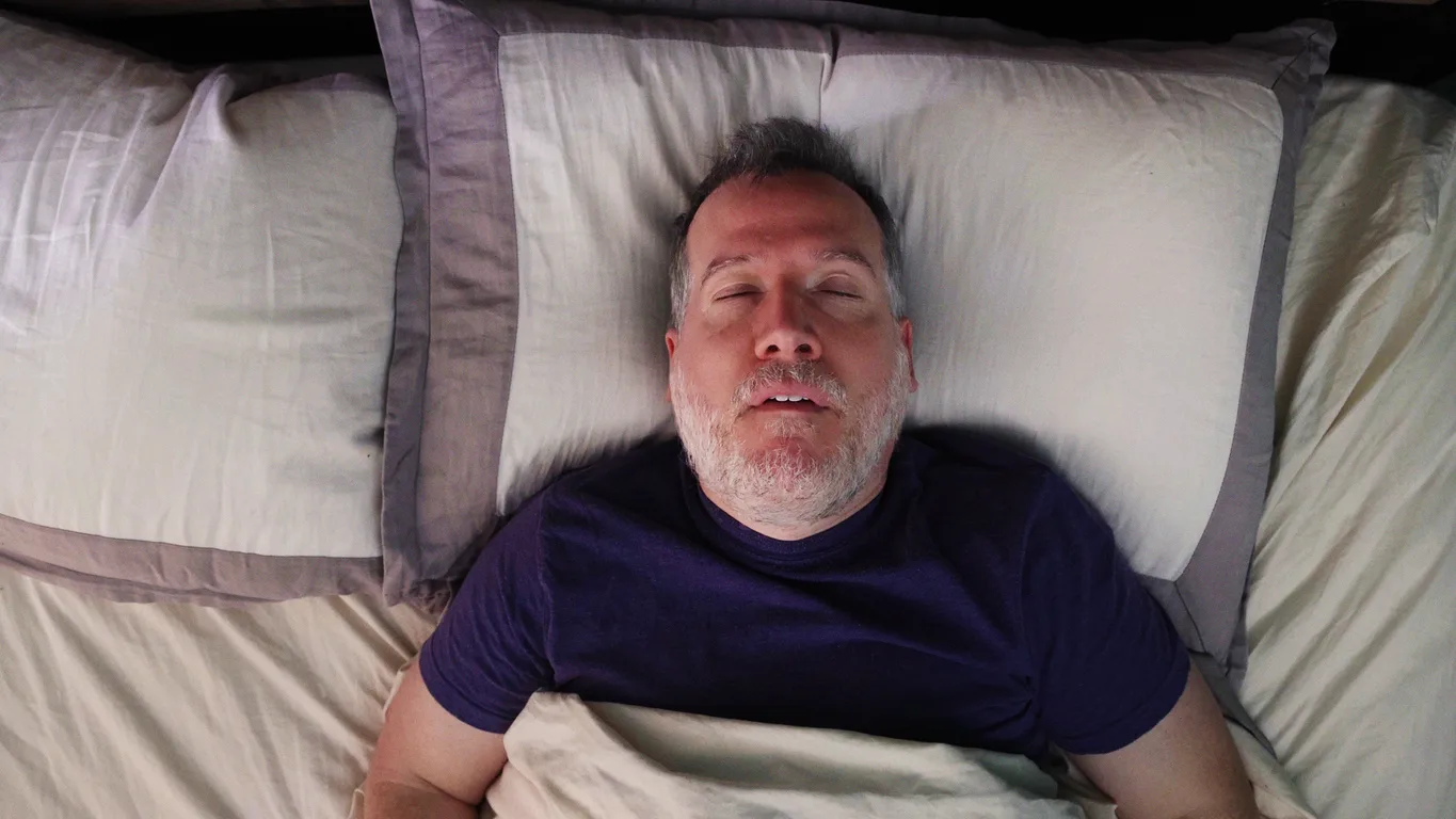 Can Obstructive Sleep Apnea Cause Chronic Venous