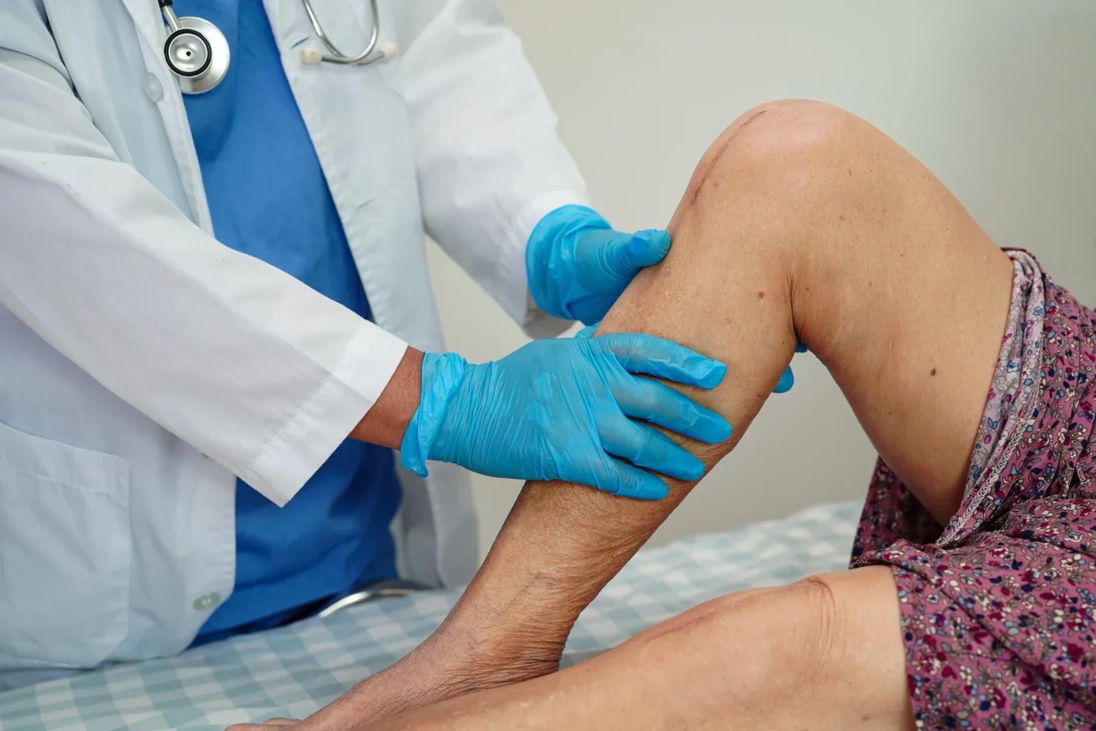 Getting to the Heart of Chronic Venous Insufficiency