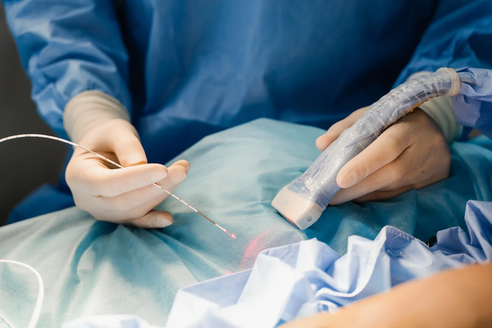 Treatment of Chronic Venous Insufficiency