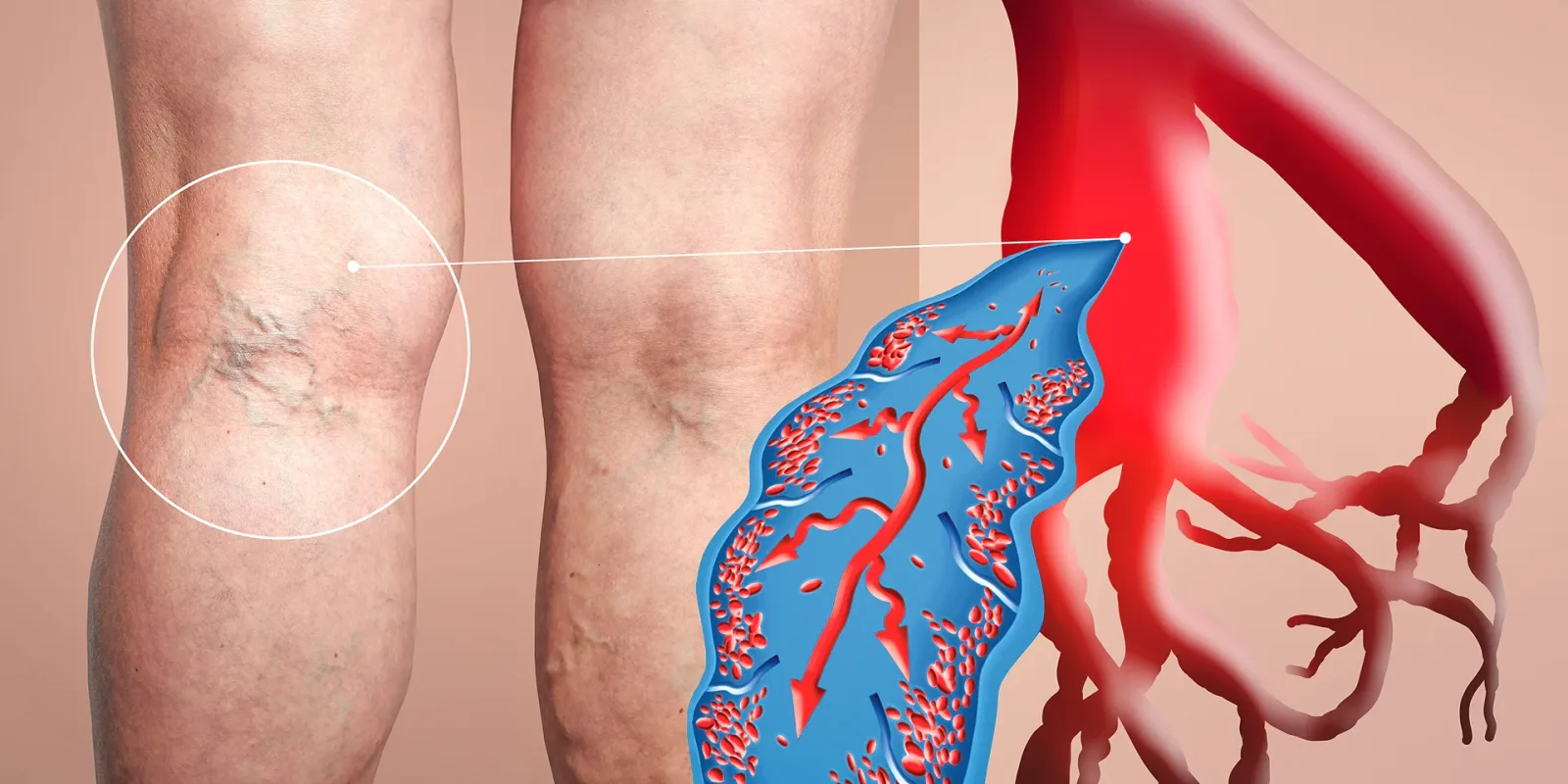 Understanding Vein and Dermatology Treatment of Chronic